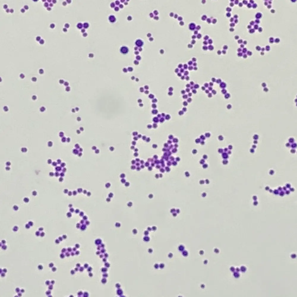 BiTTE® - Microbial Analysis - CarbConnect AI-powered medical imaging analysis tool for healthcare professionals and research institutions