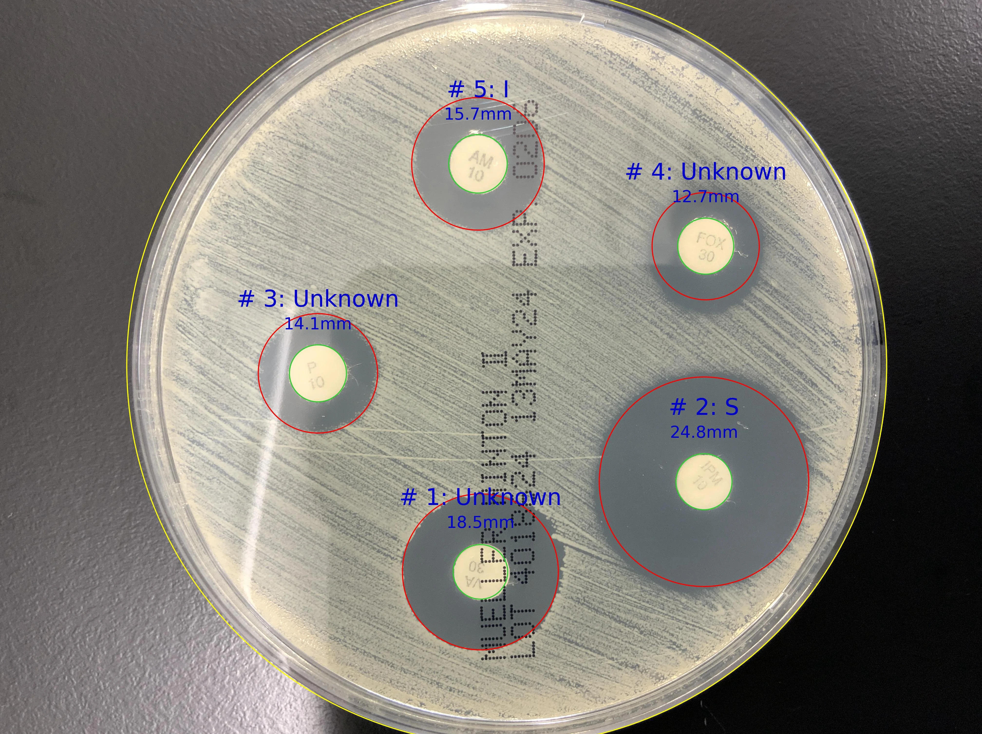 ZOI PRO - Professional Zone of Inhibition - Advanced medical AI module for Zone of Inhibition measurement ZOI PRO - Professional Zone of Inhibition - CarbConnect AI-powered medical imaging analysis tool for healthcare professionals and research institutions