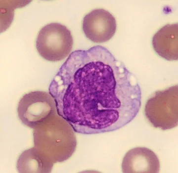 BM Smear AI 1.0 - Advanced medical AI module for bone marrow smear classification BM Smear AI 1.0 - CarbConnect AI-powered medical imaging analysis tool for healthcare professionals and research institutions