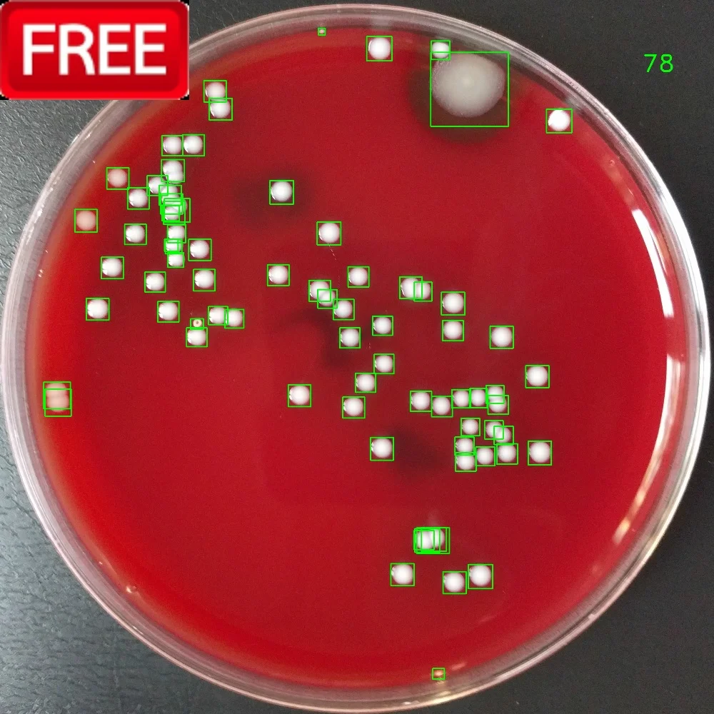 Colony Counter - Advanced medical AI module for bacterial colony counting Colony Counter - CarbConnect AI-powered medical imaging analysis tool for healthcare professionals and research institutions