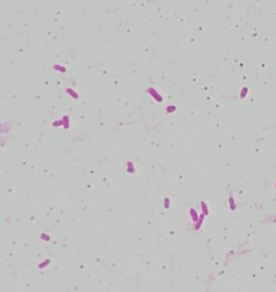 BiTTE lite - Microbial Analysis - Advanced medical AI module for microbial analysis and identification BiTTE lite - Microbial Analysis - CarbConnect AI-powered medical imaging analysis tool for healthcare professionals and research institutions