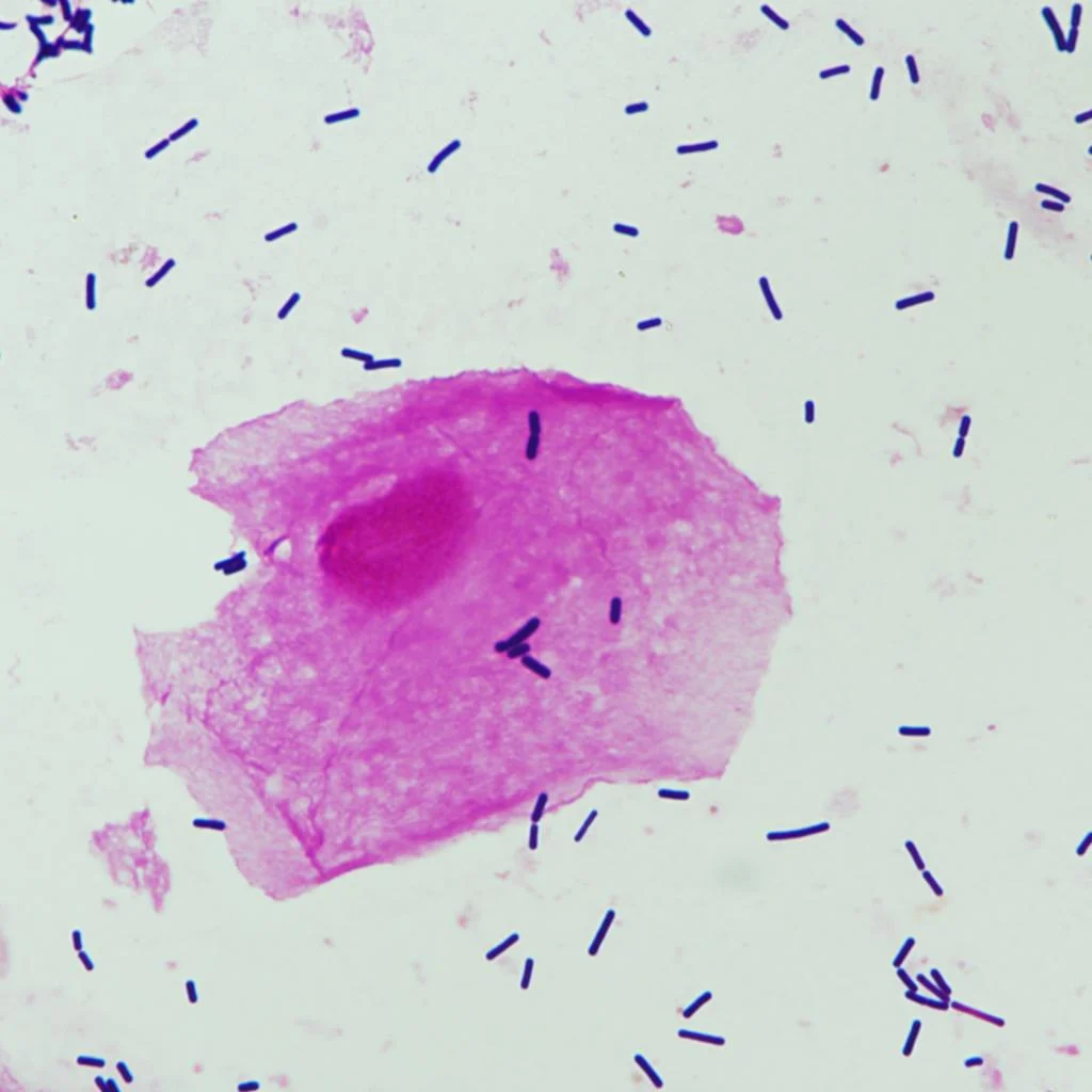 Nugent Score AI 1.0 - Advanced medical AI module for Nugent score calculation Nugent Score AI 1.0 - CarbConnect AI-powered medical imaging analysis tool for healthcare professionals and research institutions