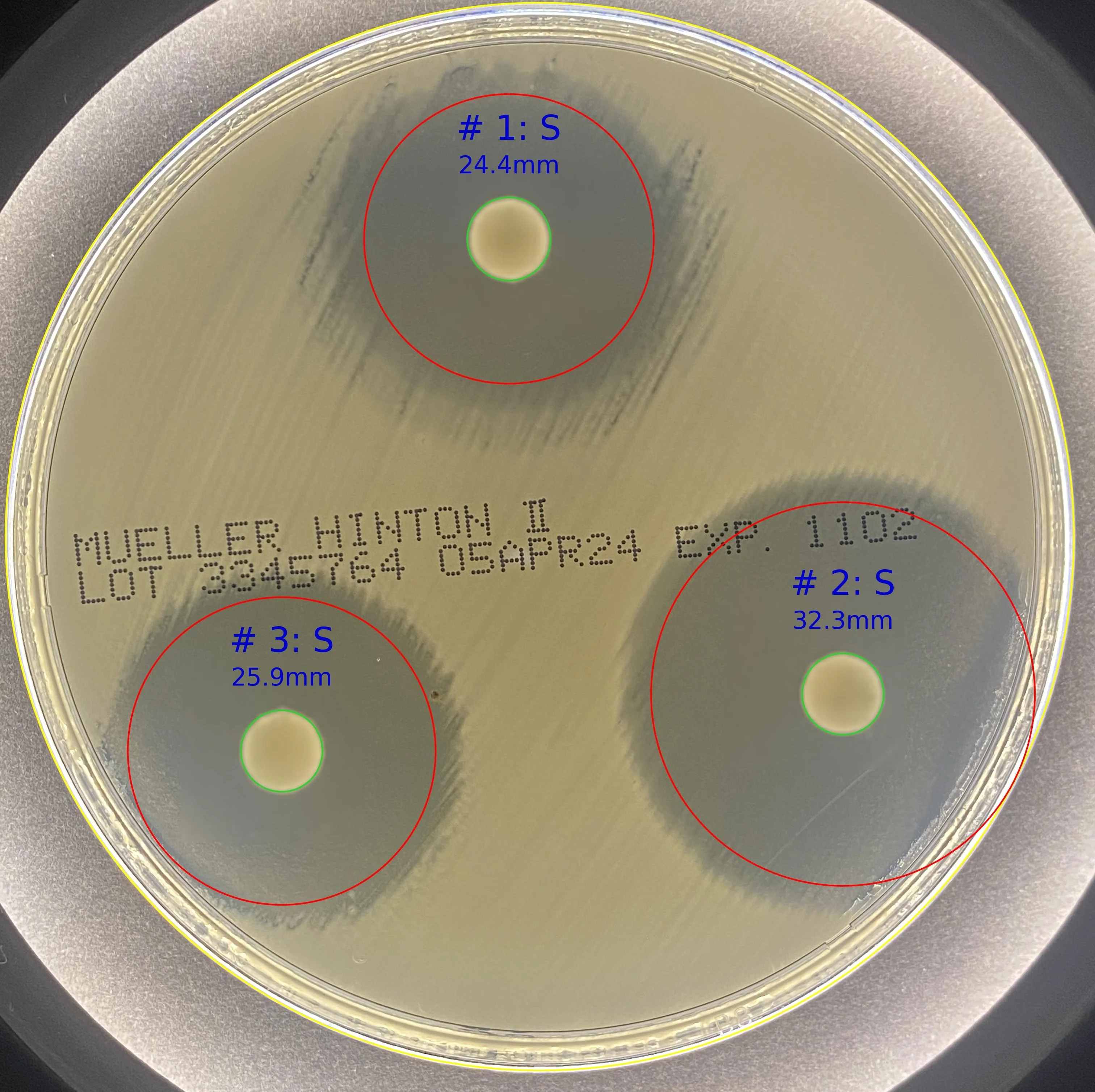 ZOI VET - Veterinary Zone of Inhibition - Advanced medical AI module for Zone of Inhibition measurement ZOI VET - Veterinary Zone of Inhibition - CarbConnect AI-powered medical imaging analysis tool for healthcare professionals and research institutions