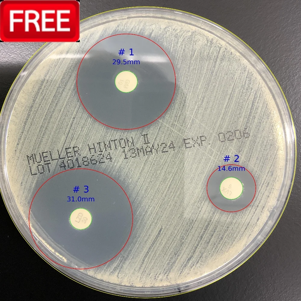 ZOI 1.0 - Zone of Inhibition - Advanced medical AI module for Zone of Inhibition measurement ZOI 1.0 - Zone of Inhibition - CarbConnect AI-powered medical imaging analysis tool for healthcare professionals and research institutions